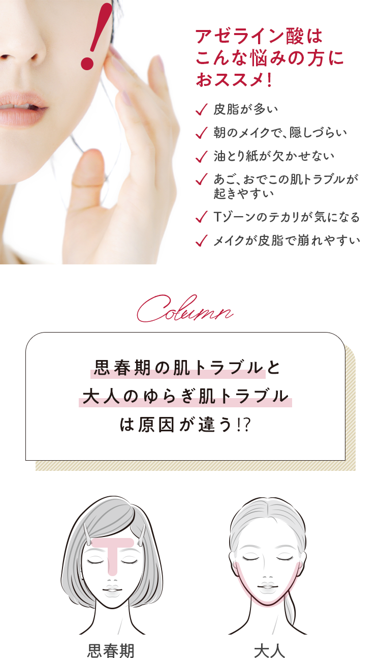 アゼライン酸はこんな悩みの方におススメ！皮脂が多い 朝のメイクで、隠しづらい 油とり紙が欠かせない あご、おでこの肌トラブルが起きやすい Tゾーンのテカリが気になる メイクが皮脂で崩れやすい 思春期の肌トラブルと大人のゆらぎ肌トラブルは原因が違う!?