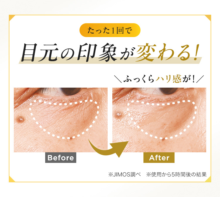 たった1回で目元の印象が変わる！